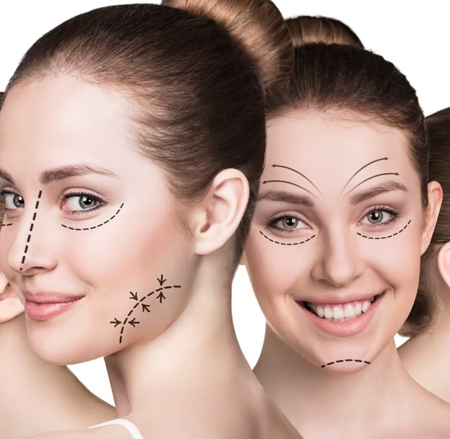 Facelift